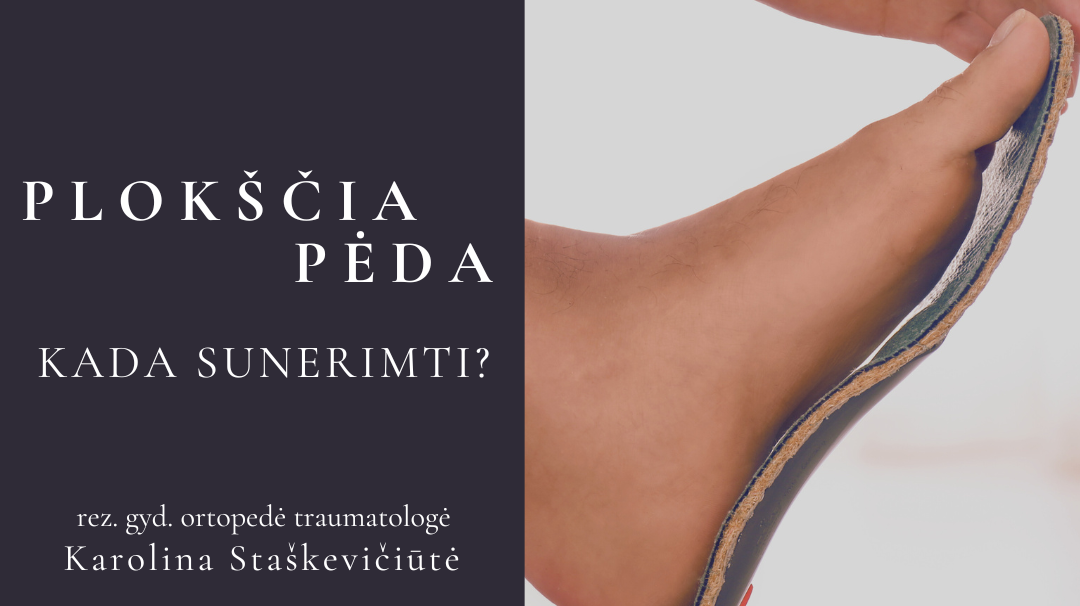 Plokščia pėda. Kada sunerimti?