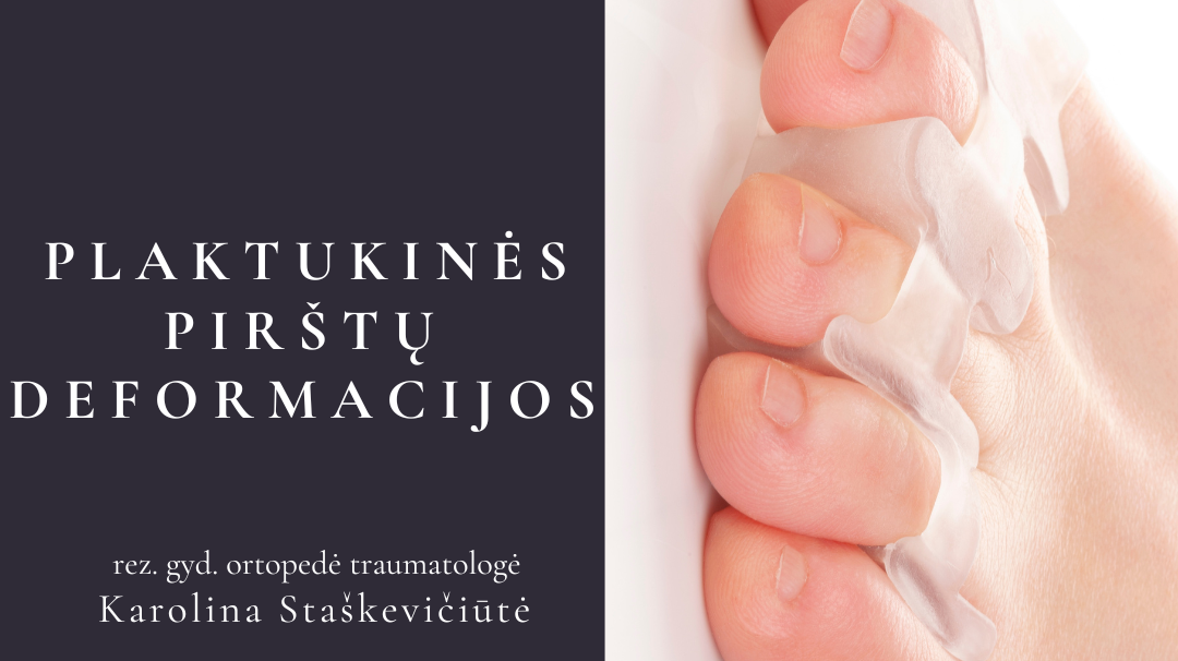 Plaktukinės pirštų deformacijos