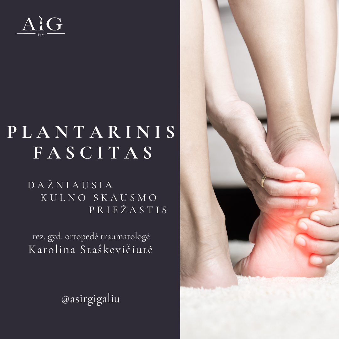 Plantarinis fasictas - dažniausia kulno skausmo priežastis